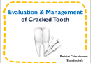 Evaluation &Mwngement of cracked Tooth
